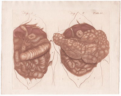 Views of the Omentum